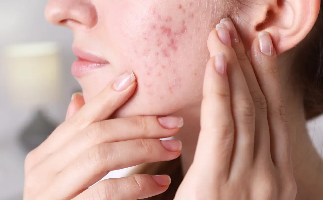 ضد آفتاب بی رنگ | شیک شیم