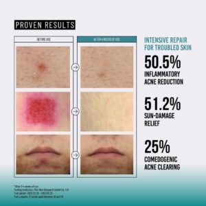 اسنس آبرسان حلزون و پپتاید جومیسو ۱۴۰میل 3 کاربرد اسنس آبرسان حلزون و پپتاید جومیسو ۱۴۰میل