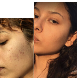 فوم شستشوی سراوی پوست نرمال تا چرب Gel-Moussant حجم ۴۷۳میل 4 فوم شستشوی سراوی پوست نرمال تا چرب