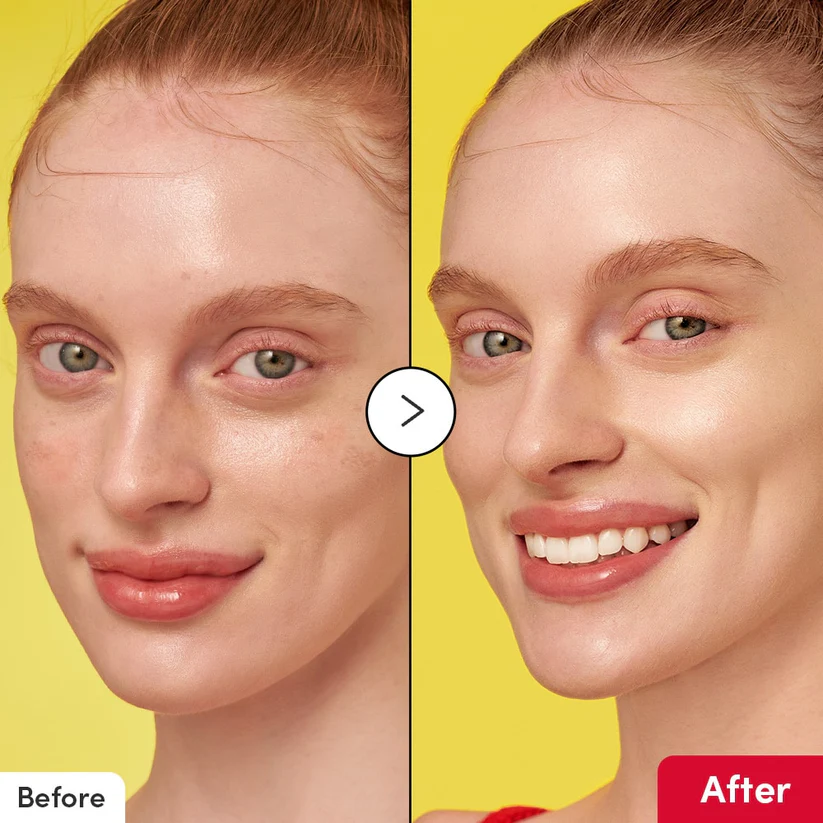 سرم ضد لک و روشن کننده اکوال بری ۳۰میل 1 سرم ضد لک و روشن کننده اکوال بری