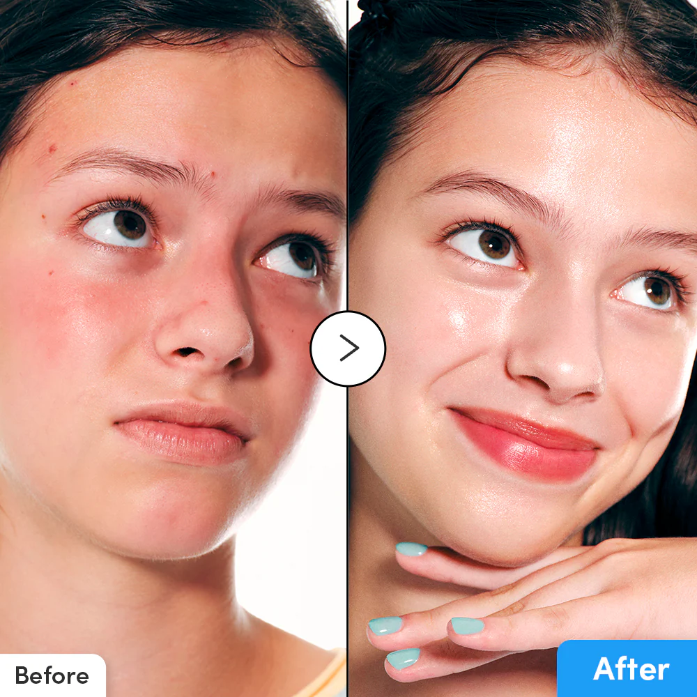 سرم ترمیم و التیام بخش آلوئه PDRN اکوال بری ۳۰میل 1 سرم ترمیم و التیام بخش آلوئه PDRN اکوال بری