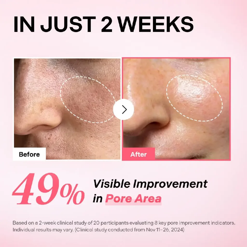 آمپول کوچک کننده منافذ توریدن ۳۰میل 1 آمپول کوچک کننده منافذ توریدن ۳۰میل