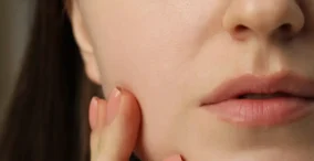 dry-skin-sunscreen | shikshim